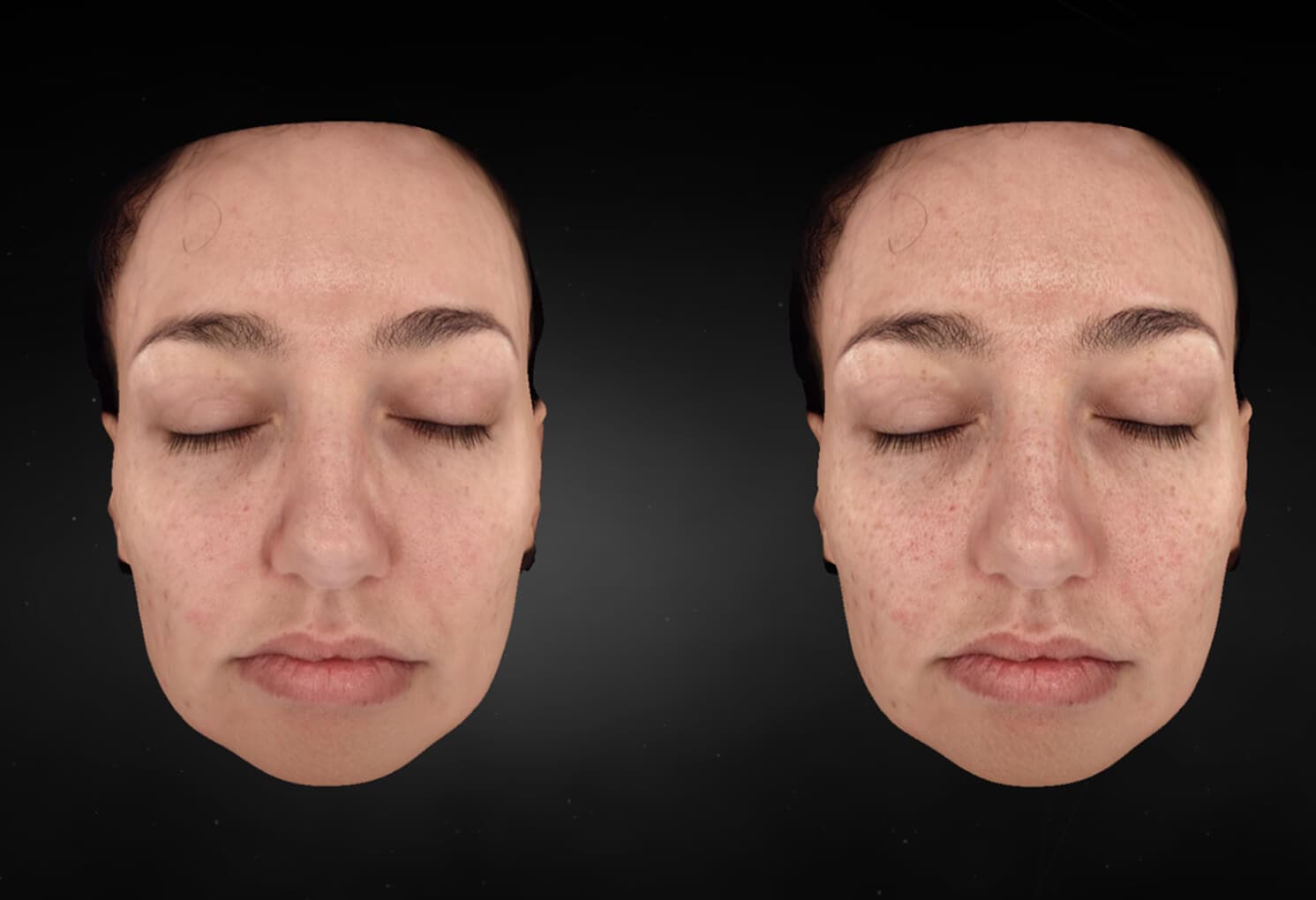 Unlocking 35% More Clarity with DermSight’s Advanced Skin Analysis